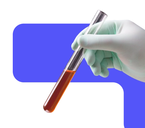 A person with a glove is holding a test tube. 